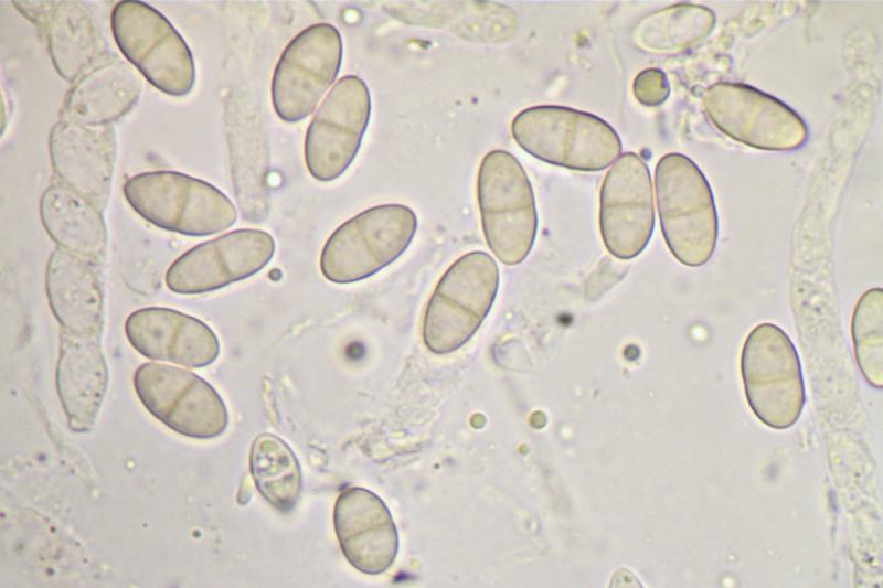 macrostoma