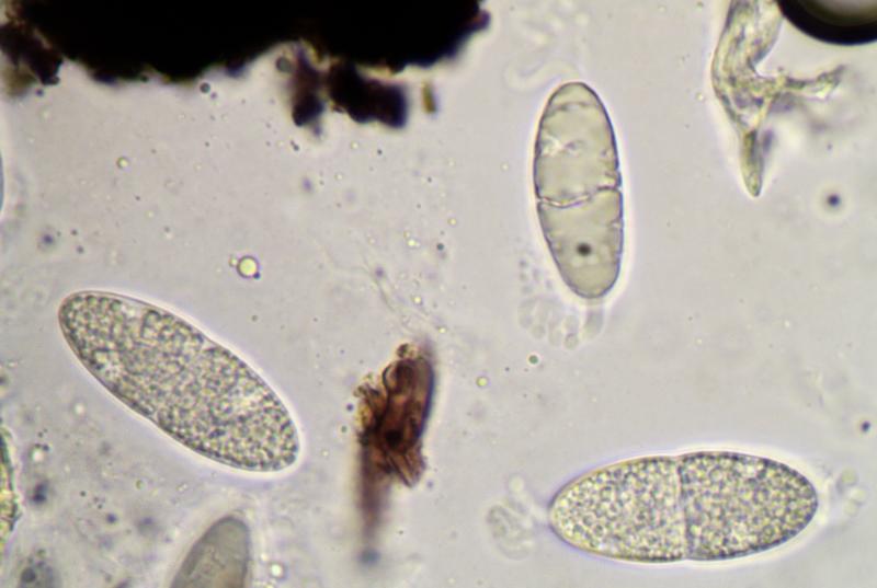 macrostoma