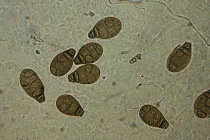 macrostoma