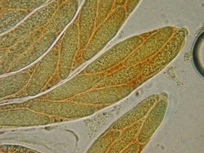 macrostoma