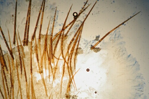 macrostoma