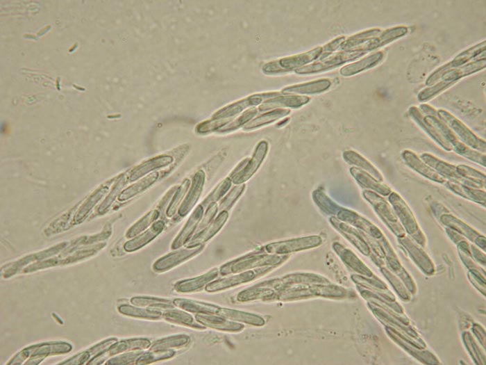 macrostoma