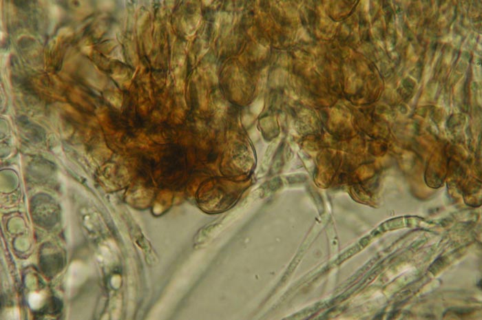 macrostoma