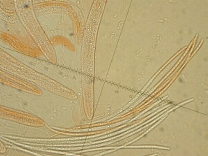 macrostoma