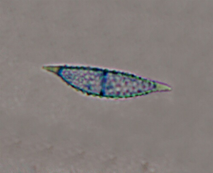 macrostoma