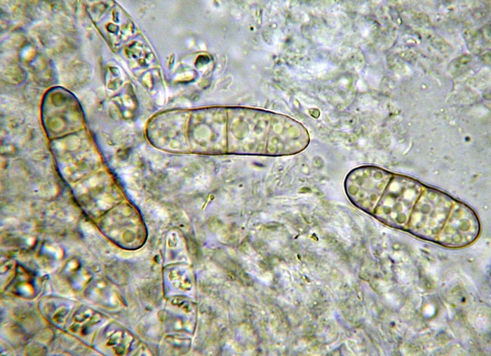 macrostoma