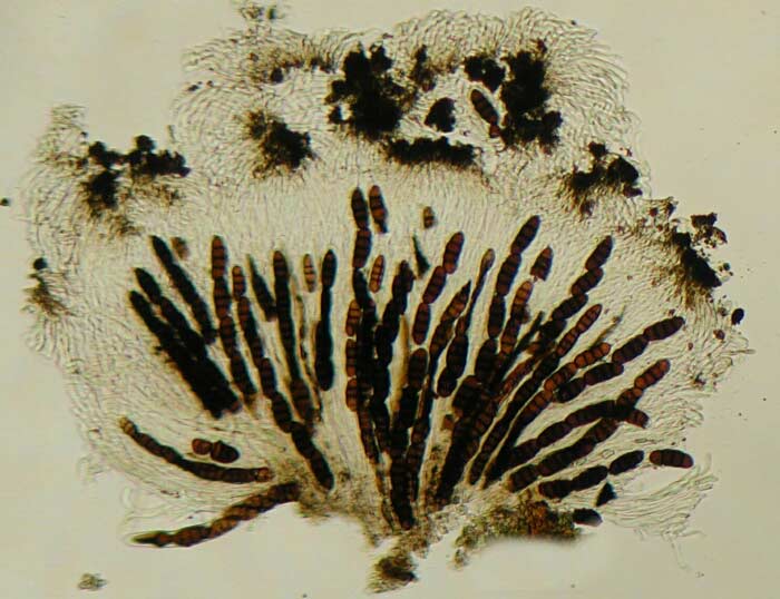 macrostoma