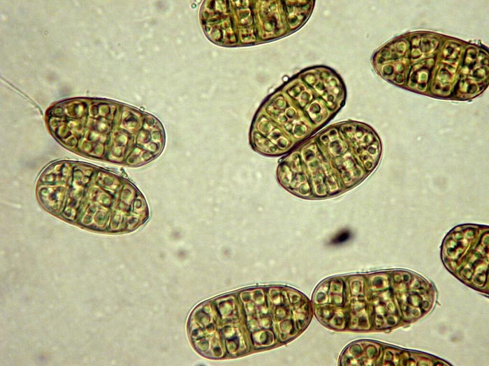 macrostoma