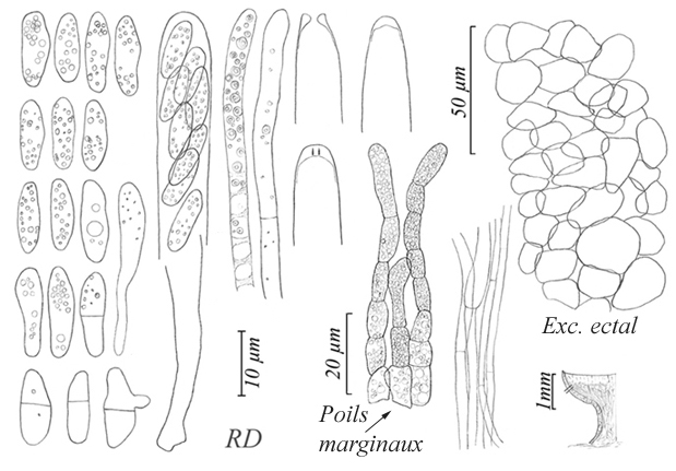 macrostoma