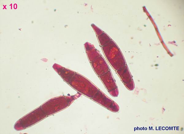 macrostoma