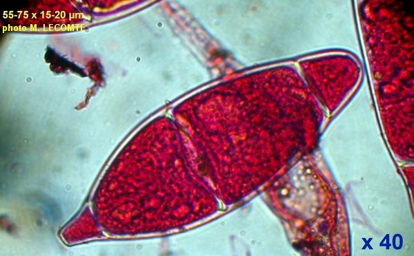 macrostoma