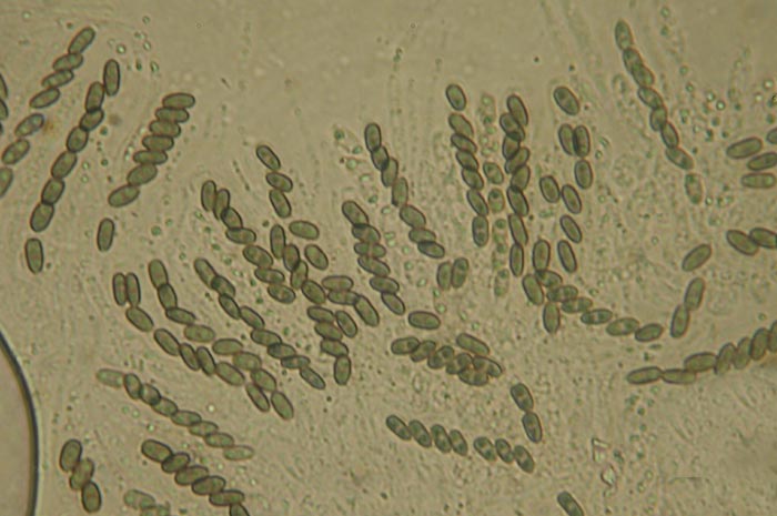 macrostoma