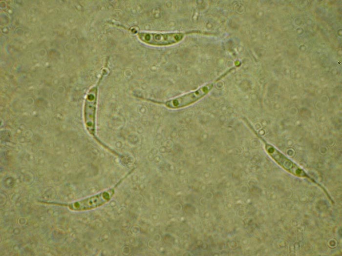 macrostoma