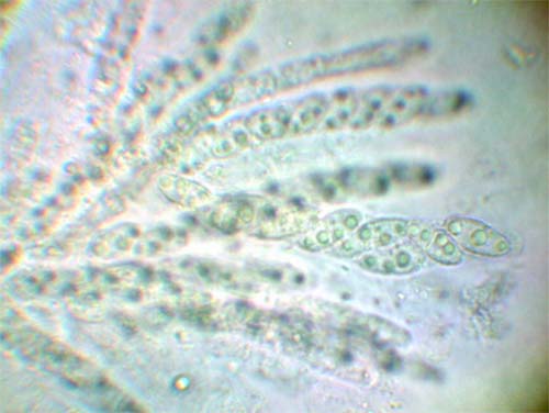 macrostoma