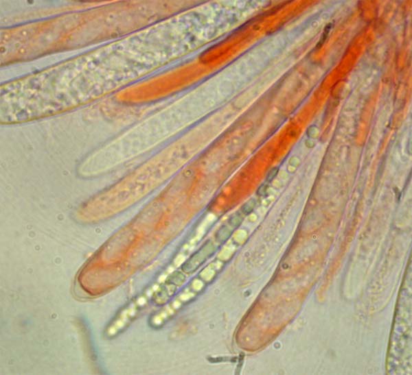 macrostoma