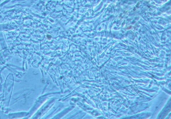 macrostoma
