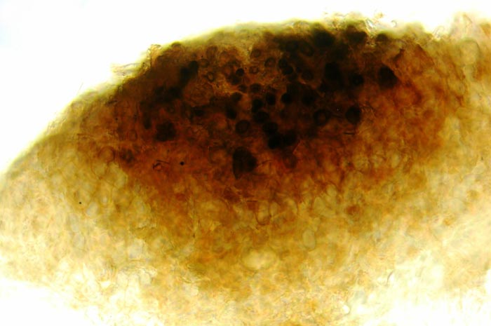 macrostoma