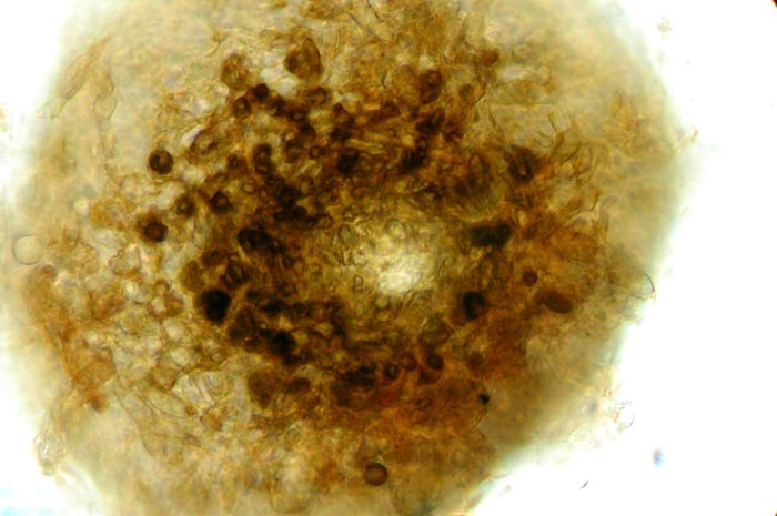 macrostoma