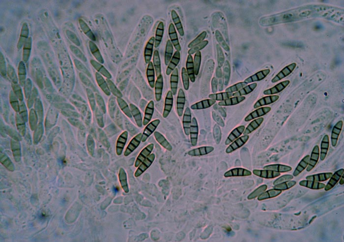 macrostoma