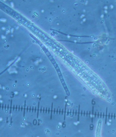 macrostoma