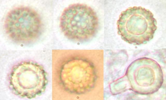 macrostoma