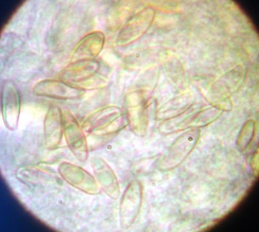macrostoma
