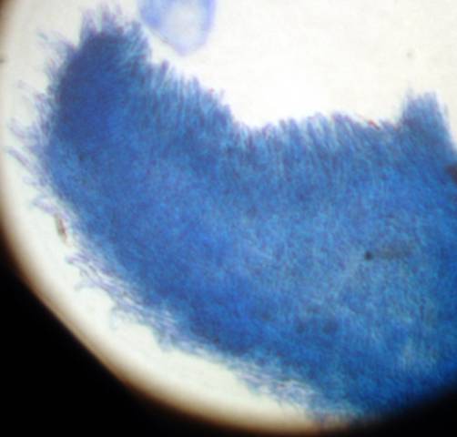 macrostoma