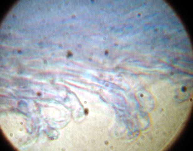 macrostoma