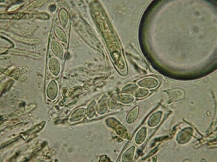 macrostoma