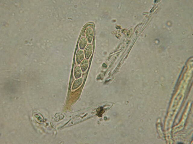 macrostoma