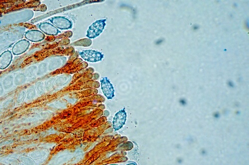 macrostoma