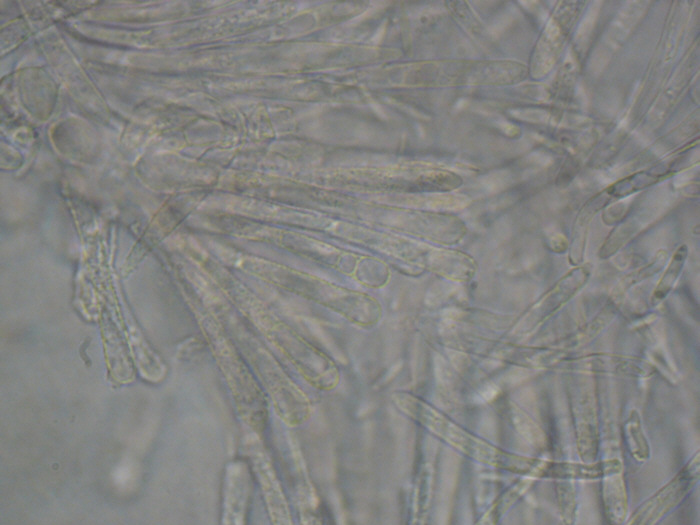 macrostoma