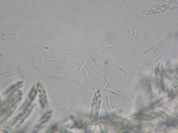 macrostoma