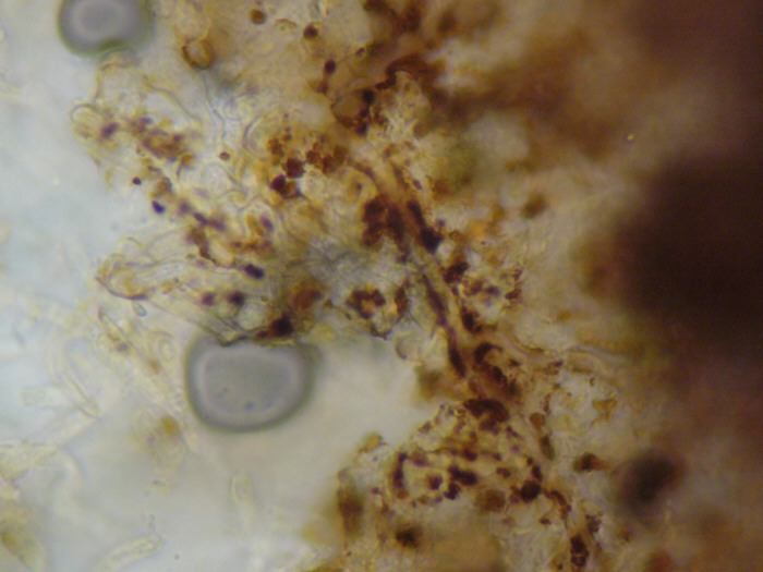 macrostoma