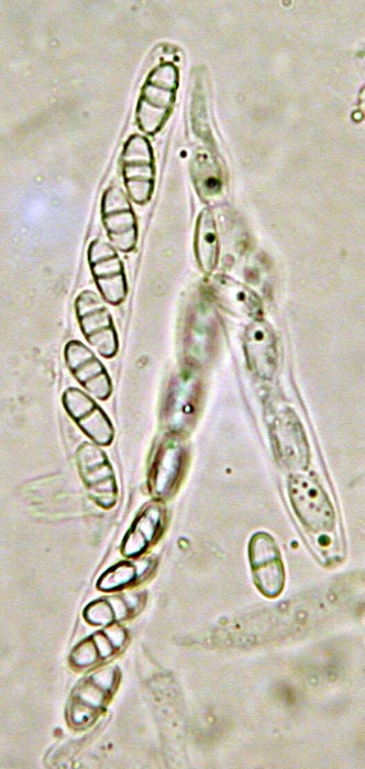 macrostoma