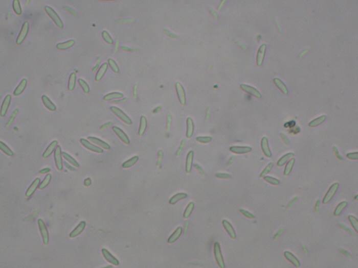 macrostoma