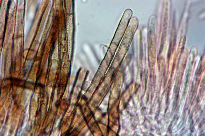 macrostoma