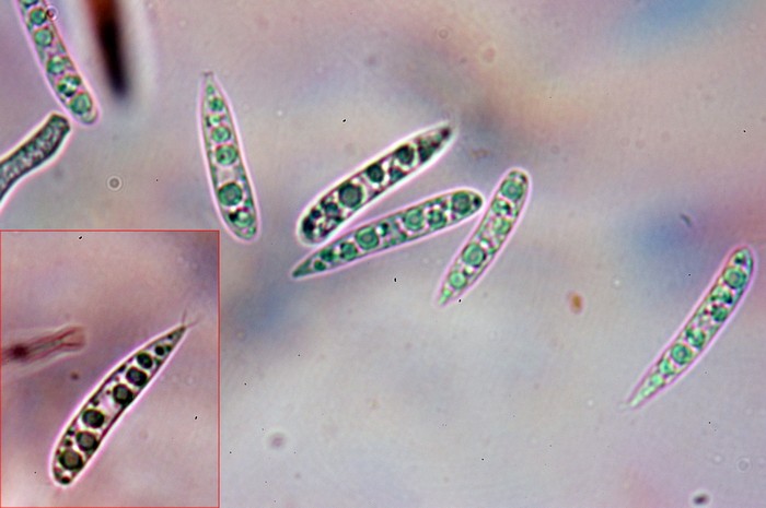 macrostoma