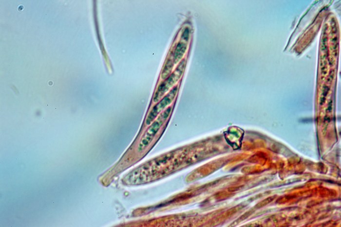 macrostoma