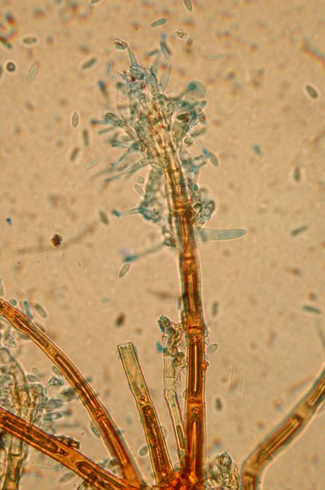 macrostoma