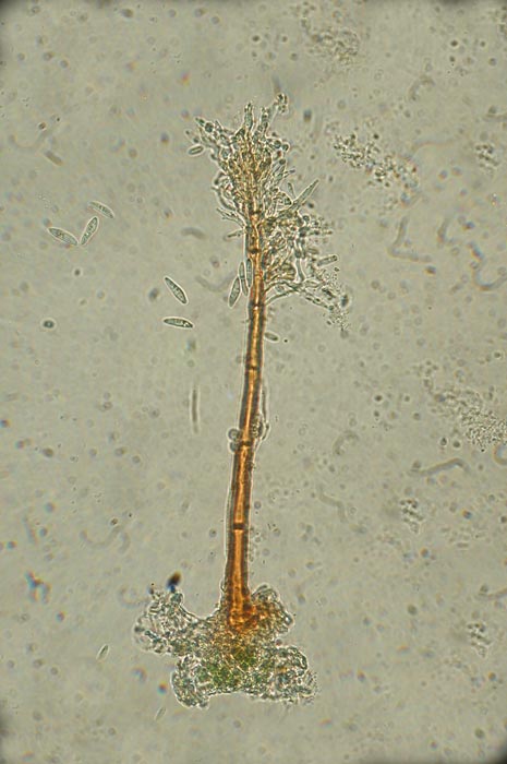 macrostoma