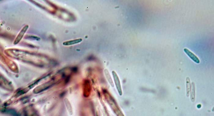 macrostoma