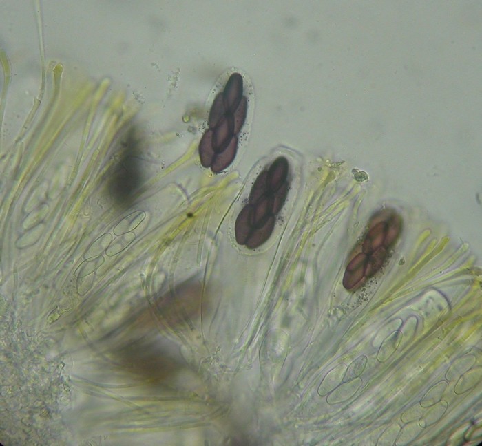 macrostoma