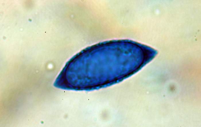 macrostoma
