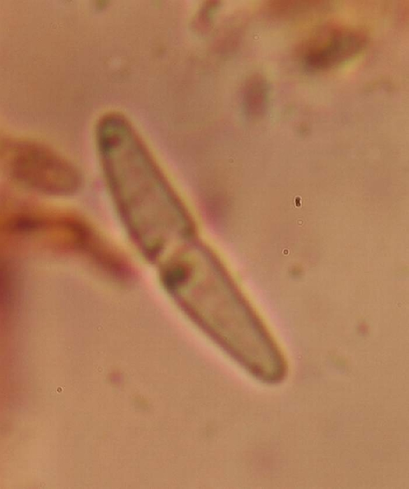 macrostoma