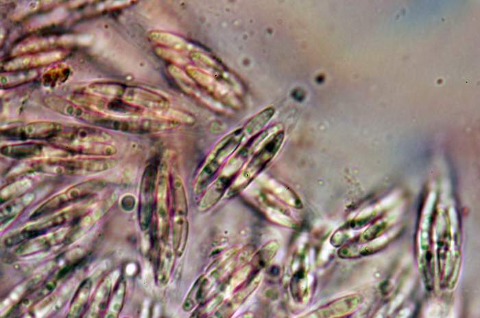 macrostoma