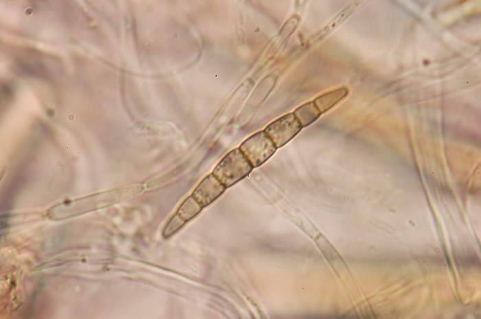 macrostoma