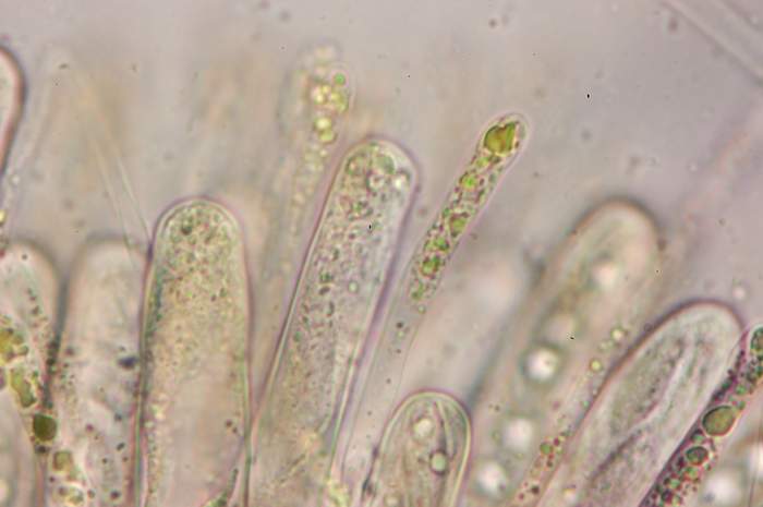 macrostoma