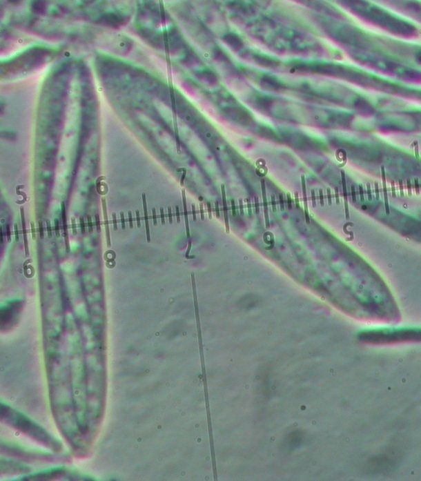 macrostoma