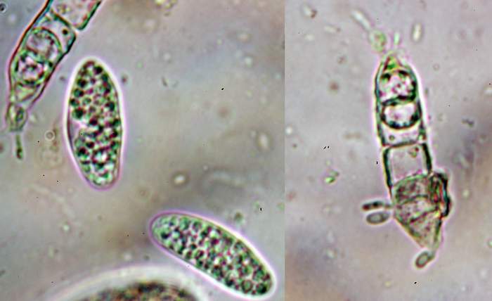 macrostoma